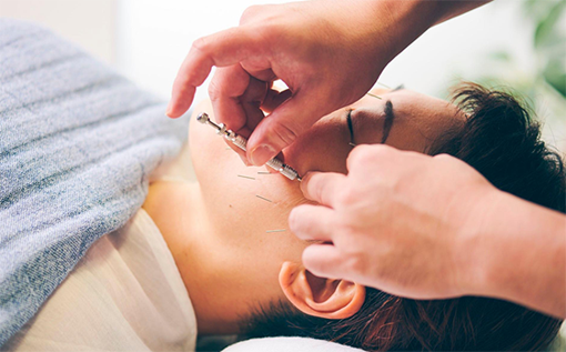 美容鍼灸整体