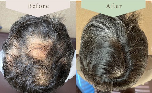 50代男性（コロナ後遺症）